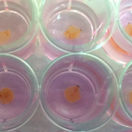 Endocrine Nav Image Research